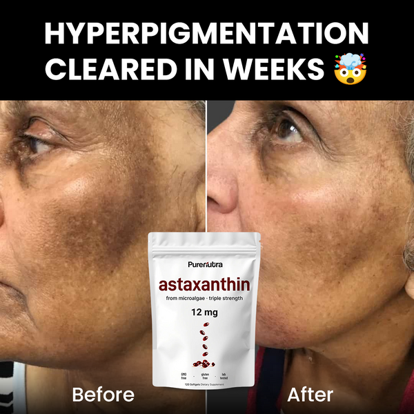 Astaxanthin Skin Defender